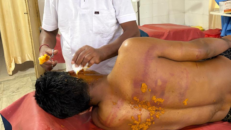 Sacerdotes catolicos son brutalmente agredidos durante asalto a una iglesia en la India
